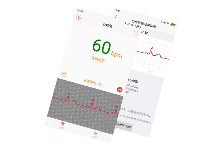 APP集成實(shí)例---心電芯片、心電手環(huán)芯片、可穿戴心電設(shè)備、智能監(jiān)護(hù)儀